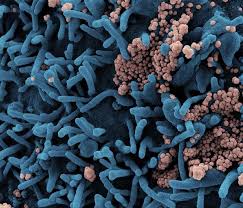 An astrazeneca news release on sunday said that out of 17 million people who received their vaccine in the european union and the uk, there were 15 events of deep vein thrombosis and 22 events of. Investigational Astrazeneca Vaccine Prevents Covid 19 National Institutes Of Health Nih