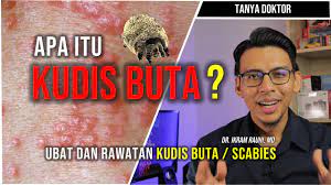 Kudis buta ni bukan senang nak baik. Apa Itu Kudis Buta Scabies Ubat Dan Cara Merawat Kudis Buta Youtube