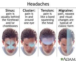 Great Headache Chart We Can Definitely Use This I Get
