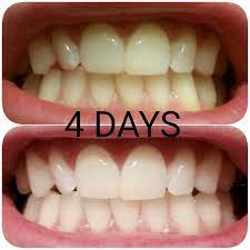 Pin On Magic Tooth Paste