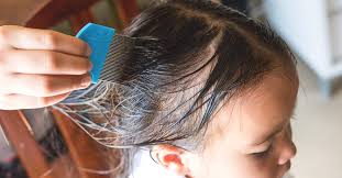 Lice comb highly effective removing lice nits hair treatment brush shampoo kids. Drug Resistant Super Lice Symptoms Treatment And Prevention