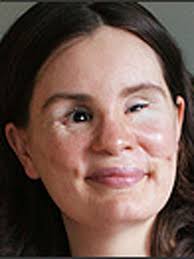 Jury asked to award Federici $38 million