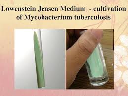 Lj medium, lowenstein jensen medium. Bacterial Media Culture Basics Ppt Download
