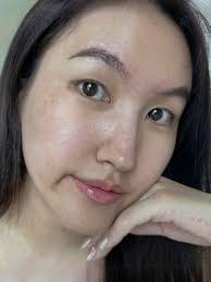 Who does the best fillers...botox etc.? Doctor please!!!!