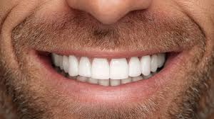 After treatment