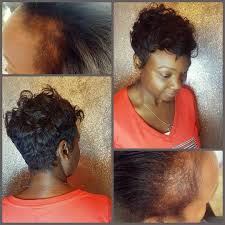 Dallas Black Hairstylist Treat Thinning Hair Black Women Hair Loss Hair Loss Treatment