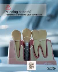 Dental Implants: Restoring More Than a Smile Your smile is more than  aesthetics; it's confidence, comfort, and quality of life. Dental implants  are designed to look, feel, and function like natural teeth