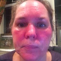 Gene expression is determined by quantitative real-time polymerase...