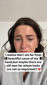 Amputte Natalie Palance