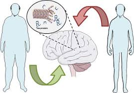 Check spelling or type a new query. Metabolically Healthy Obesity And Lipids May Be Protective Factors For Pathological Changes Of Alzheimer S Disease In Cognitively Normal Adults Journal Of Neurochemistry X Mol
