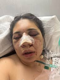 Fundraiser for Kasey King by Kelby Mercadal : Support Kasey and Karina's  Recovery