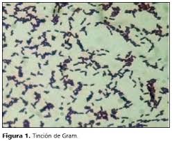 Listeria monocytogenes is a gram positive bacterium that causes listeriosis. Listeria Monocytogenes