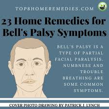 Bell's palsy is a condition that causes a temporary weakness or paralysis of the muscles in the face. Treat Bell S Palsy Symptoms Bells Palsy Home Remedies Bell S Palsy