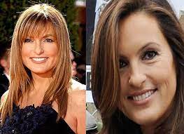 Check spelling or type a new query. Mariska Hargitay Plastic Surgery Before And After Celeb Surgery Com