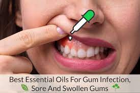 Pin On Swollen Gum