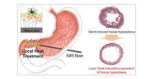 Image result for Local Heat Therapy