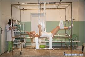 Casting Frame With Traction By Medicbrace On Deviantart It Cast Long Leg Cast Leg Cast