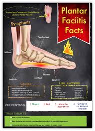 Pin On Foot Pain