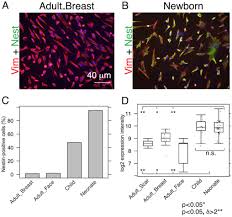 Analysis Of Dermal Fibroblasts Isolated From Neonatal And Child Cleft Lip And Adult Skin Developmental Implications On Reconstructive Surgery
