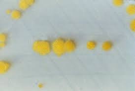 Clostridium difficile, commonly referred to as c. Figure Clostridium Difficile Cycloserine Mannitol Agar Statpearls Ncbi Bookshelf