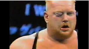 What happened when Glen Foley got hurt?