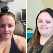 Arian mowlavi m.d., facs is an expert plastic surgeon and owner of the cosmetic plastic surgery institute knew how to tighten skin after weight loss. Thousands Of Satisfied Patients Around The World Bariatric Services