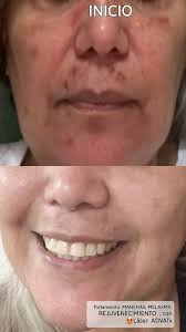 Perfil de Dermatóloga Dra. Sonia Calles