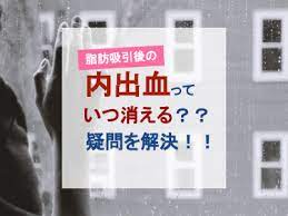 脂肪吸引後の内出血っていつ消える という疑問を解決 ベイザー脂肪吸引ラボ 脂肪吸引 脂肪 疑問