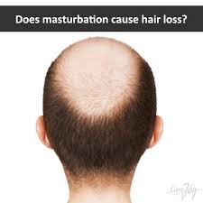 Reason of hair loss in men is generally genetic heritage. Curejoy On Twitter Does Masturbation Cause Hair Loss Curejoy Expert Answers Http T Co Qgrbjtw1sc Http T Co Cd5ltzutdu