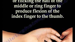 Image result for Hoffman Sign