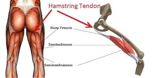 They most often occur at the middle of the back of the thigh where the muscle joins its tendon or at the base of the buttocks. Injury Spotlight Proximal Hamstring Tendinopathy Simone Muscat Physio