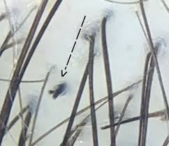 Image result for Trichoscypha silveirana