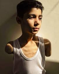 Photo of boy amputee from G***A**Z***A wins 2025 World Press Photo of the  Year 😭 🇵🇸😭💔💔