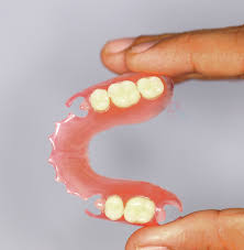 A removable partial denture (rpd) is a denture for a partially edentulous patient who desires to have replacement teeth for functional or aesthetic reasons and who cannot have a bridge (a fixed partial denture) any reason, such as a lack of required teeth to serve as support for a bridge (i.e. Flexible Dentures Removable Partial Dentures Dentcare Dental Lab