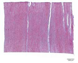 Image result for Dalbergia acutifoliolata