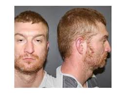 Man Accused Of Strangling A Woman To Death In Arvada