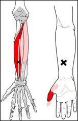 Pin On Myofascia And Trigger Point