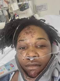Continue to send this brave woman best wishes.  https://www.11alive.com/article/news/local/henry-county-woman-hit-and-run-highway-20/85-abdd2c91-94db-4000-bbaa-0b0d5c540f3e