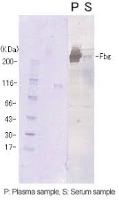 Fibrinogen degradation products fdp blood test in delhi, delhi fibrinogen degradation products fdp blood test | dr lal pathlabs fibrinogen degradation products (fdp), blood 336 diagnostic centers found for fibrinogen degradation products (fdp), blood in delhi 40ft road badarpur What S Fdp Nanopia P Fdp Blood Coagulation Diagnostics Business Sekisui Medical Co Ltd