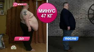 Ya Hudeyu Peredachi Telekompanii Ntv