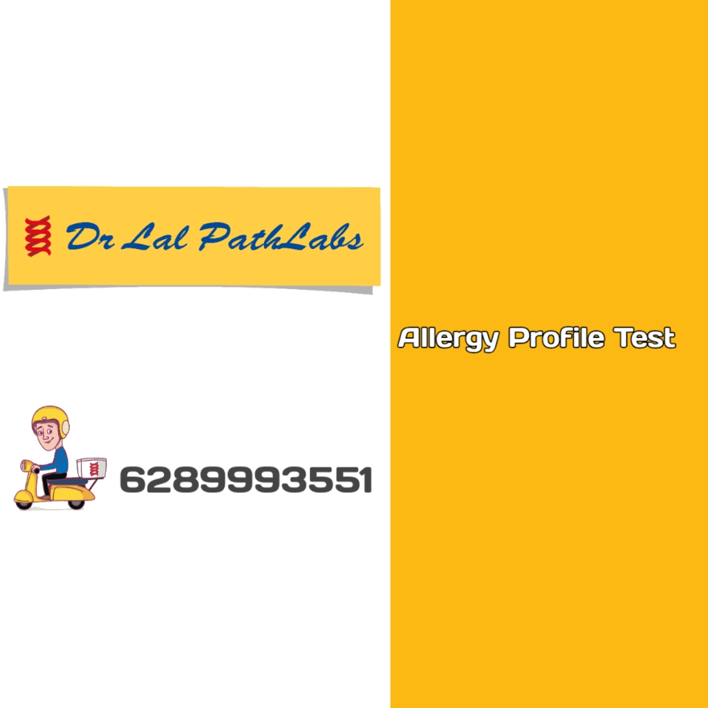 Allergy Profile Test product image