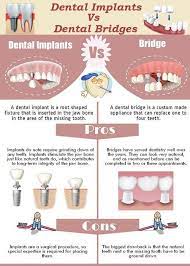 Dental Implant Vs Dental Bridges Dental Bridge Best Dental Implants Dental Implants