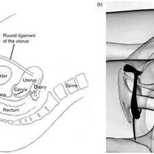 Reversible pulpitis may resolve following the removal of the offending stimulus. Relative Dexterity In Stimulating External And Internal Pelvic Download Scientific Diagram