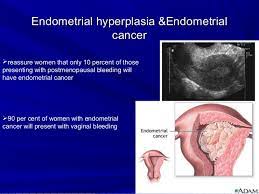 Bladder cancer can often be found early because it causes blood in the urine or other urinary symptoms. Postmenopausal Bleeding For Undergraduate