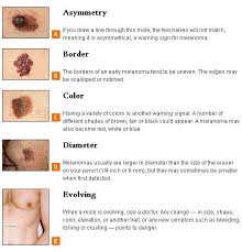 The symptoms of anxiety can be hard to detect. Anatomy In Motion Use Your Abcde To Spot Deadly Skin Cancer By Medicine Net As Pools And Beaches Beckon This Summer Be Sure To Protect Your Skin Against The Sun S Rays