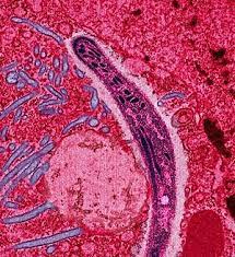 plasmodium falciparum plasmodium knowlesi plasmodium malariae plasmodium ovale plasmodium vivax. Malarie Wikipedia
