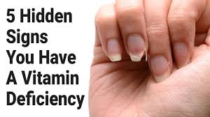 Image result for Vitamin Deficiency