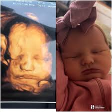 Miracles Happen 3D/4D/HD Ultrasound