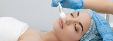 Chemical Peels Ottawa | Aesthetic Clinic | The Ottawa Skin Clinic