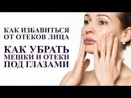 как избавиться от мешков под глазами в домашних условиях Kak Ubrat Oteki Lica V Domashnih Usloviyah Meshki I Oteki Pod Glazami Omolozhenie Lica Youtube V 2020 G Meshki Pod Glazami Pod Glazami Lico